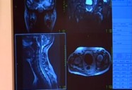 Health Care Applications: Electronics in Medical Imaging