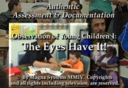 Observation I: The Eyes Have it!