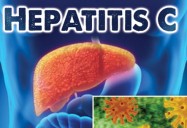 Hepatitis C: Causes, Symptoms, Prevention, Treatment
