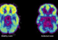 Brain Chemistry: Drug Class Series (Season 3)