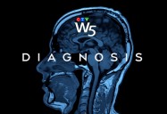 Diagnosis - A Potentially Unknown Neurological Syndrome: W5
