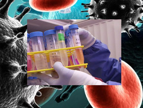 Aids: A Countdown to a Cure