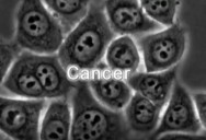 Cancer - Evolution's Deadly Result: Origins of Disease Series