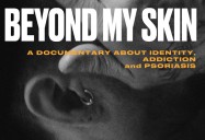 Beyond My Skin: A Documentary about Identity, Addiction and Psoriasis